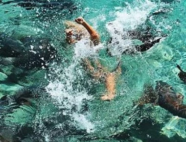 Σοκάρει το μοντέλο: «Δέχτηκα επίθεση από καρχαρία. Ένιωθα τα δόντια του να βυθίζονται στο χέρι μου»